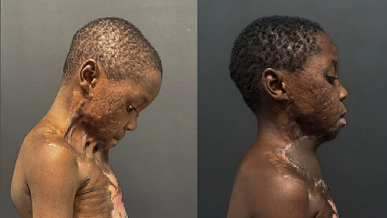 Boynu yandı, çenesi gövdesine yapıştı! Devasını Türkiye'de buldu...