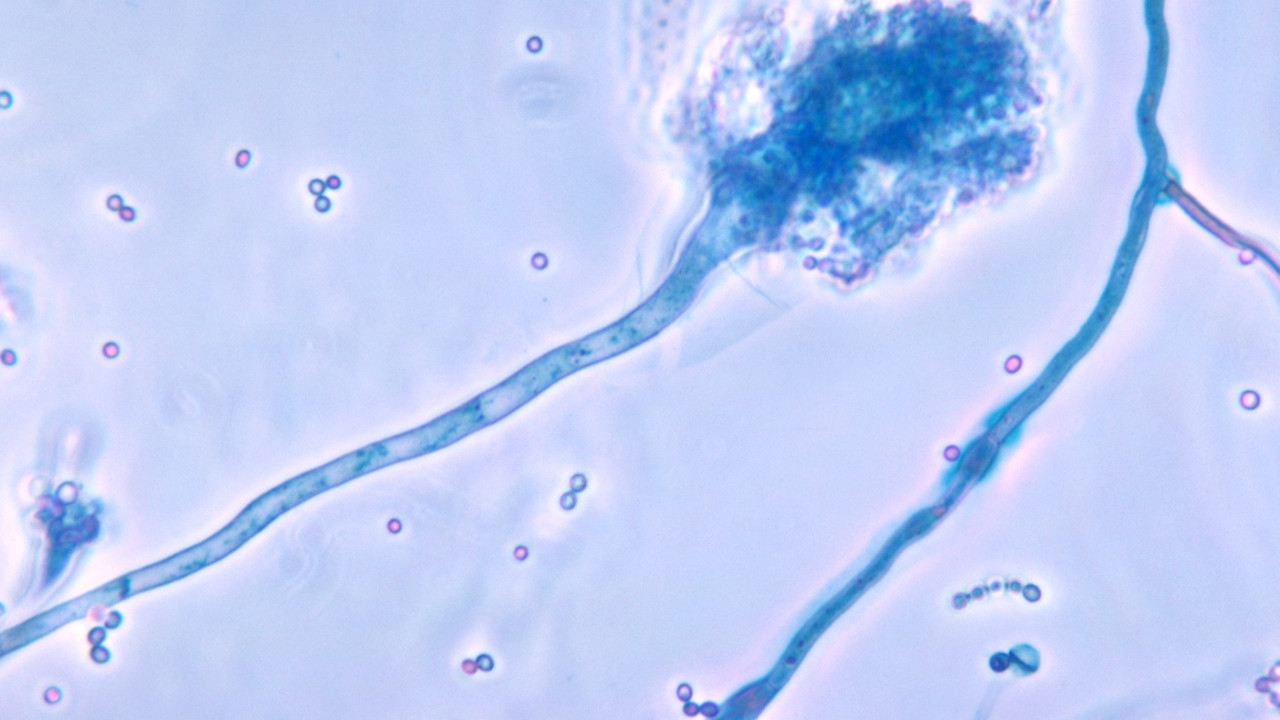 Avrupa ve Asya'ya yayılabilir! 2100 yılına kadar yüzde 77 artacak