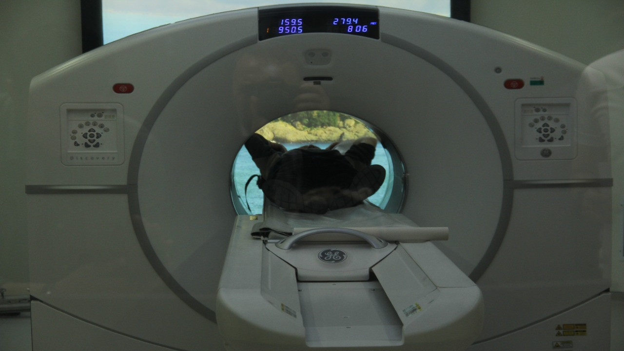 Giresun'da atipik kanser vakaları neden artıyor?