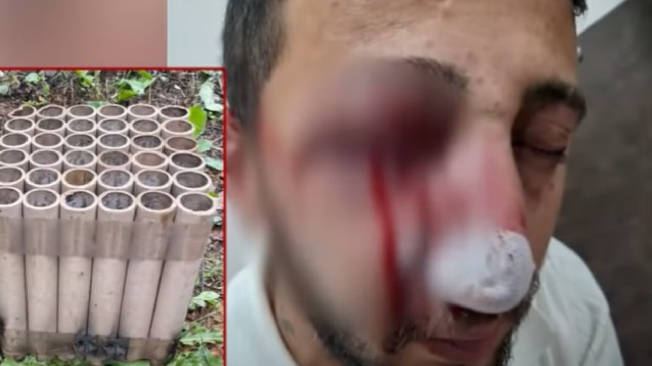 Düğüne gitti başına gelmeyen kalmadı! Sakarya'da akılalmaz olay