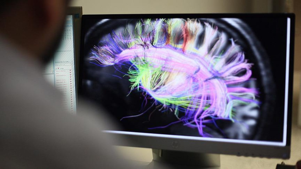 Sosyal medya beyni nasıl etikiliyor? İşte bilgisayarlı tomografi ile yapılan araştırma