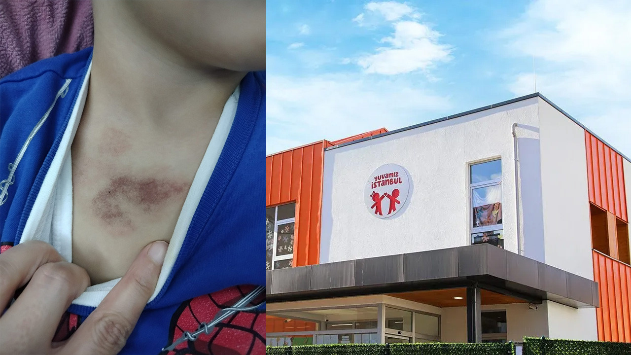 CHP Genel Başkanı ‘Morlukları öğretmen aileye haber verdi’ demişti! Aile Özgür Özel’in iddialarını yalanladı