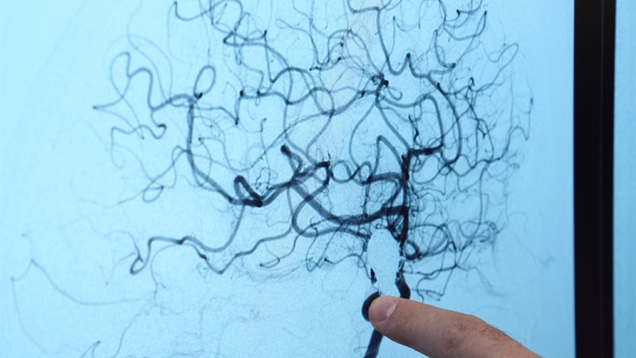 Uzmanlar uyardı: Her 20 kişiden birinde var!