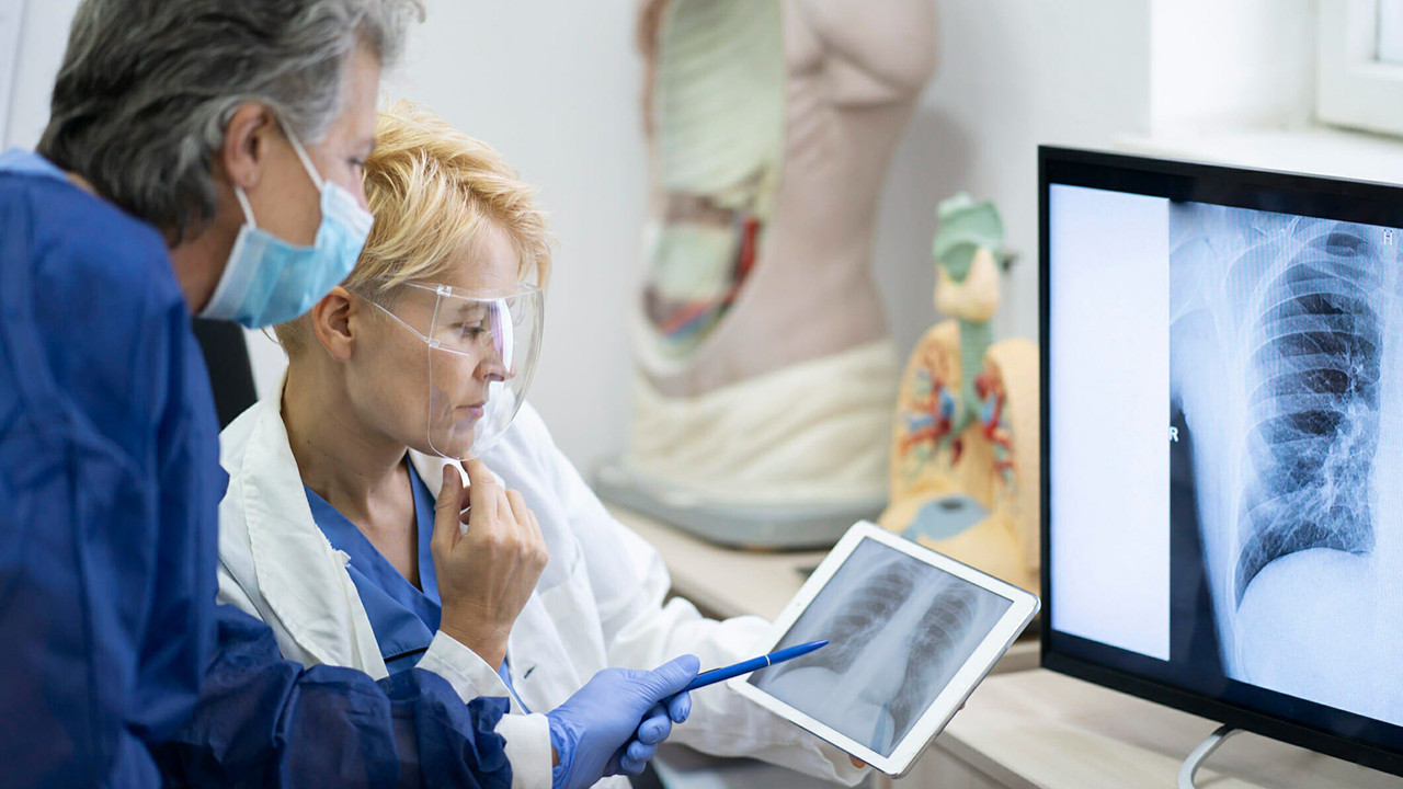 Nadir hastalıkta geç tanı kalıcı hasar demek