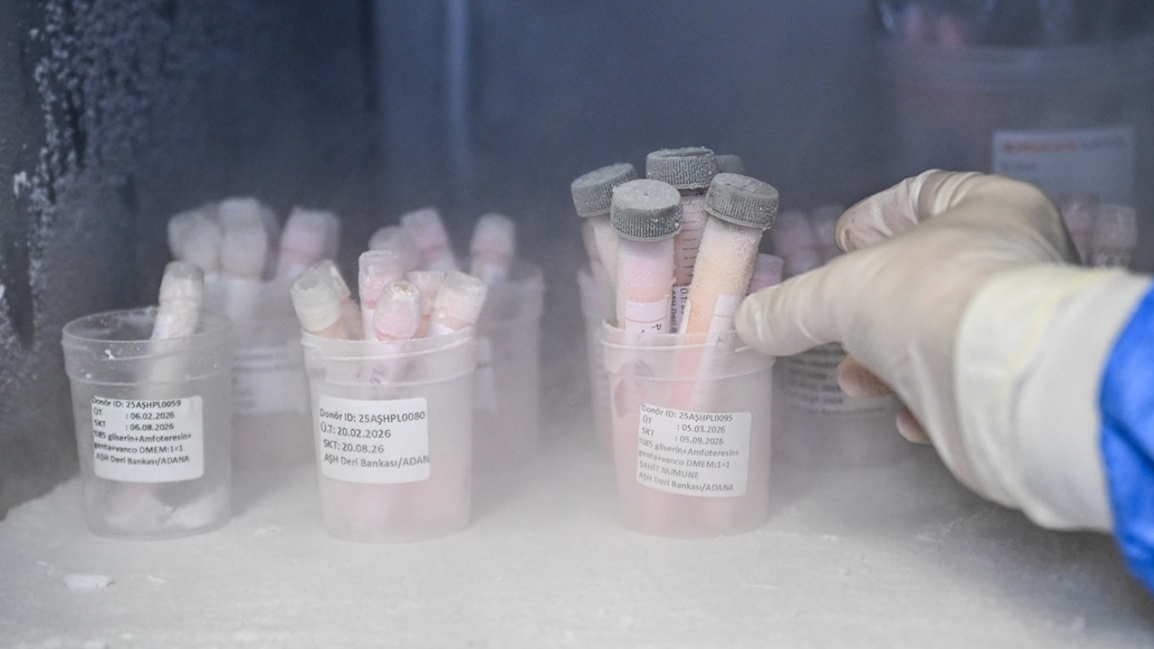 Adana'da ilginç tesis! Ölen insanların derilerini kullanıyorlar