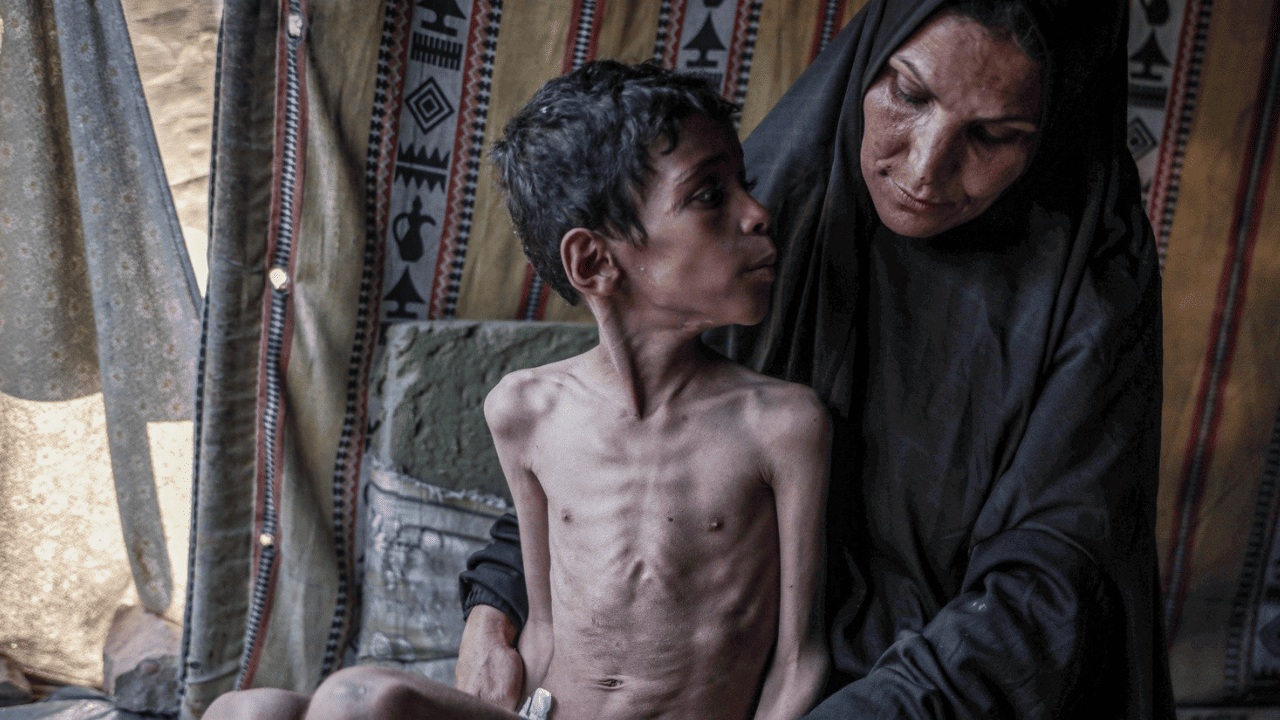 Gazze'de açlık alarmı: 10 yaşındaki Muhammed’in yaşam mücadelesi yürek burkuyor