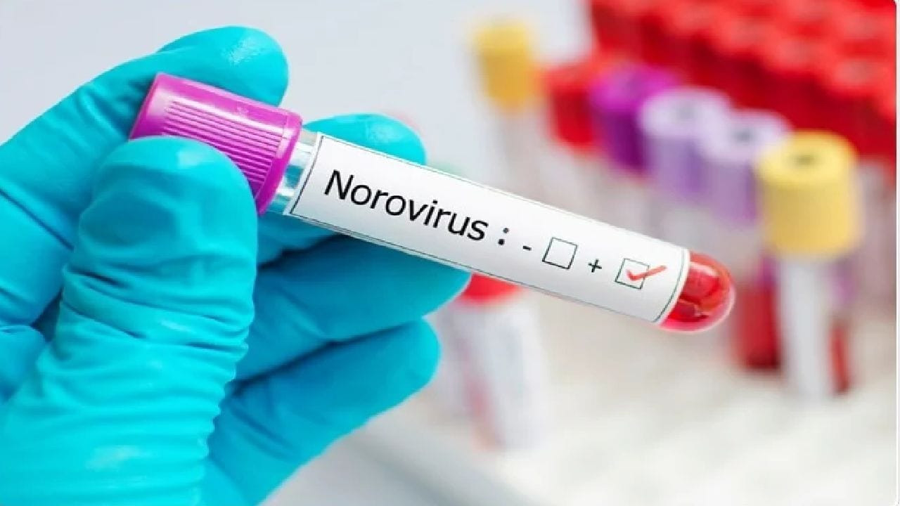 Norovirüs nedir? Norovirüs hangi ülkelerde var, Türkiye'de görüldü mü?
