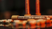 DSÖ: KDC’deki Ebola salgınında genel risk çok yüksek