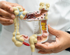 Divertiküler kanama nedir, neden olur? Murat Cimcir'den ötürü merak ediliyor