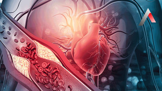 Uzman isim uyardı: Damar tıkanıklığının büyük bedeli var