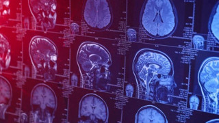 İnsan beyninin en verimli olduğu yaş aralığı belli oldu: Bu yaşlarda zirve yapıyor