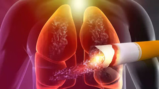 Akciğer kanserinin en büyük nedeni! Uzman isim uyardı