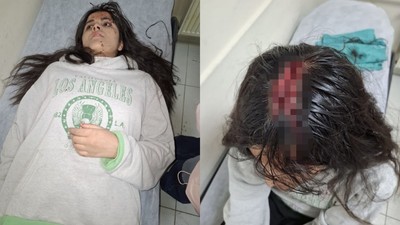 Hakkari’de feci olay! Binanın 4. katından düşen buz kütlesi genç kızı yaraladı