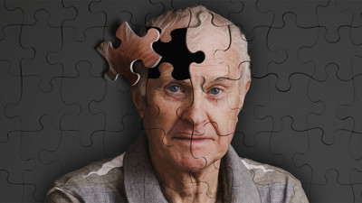Yeni bir kan testi, Alzheimer riskini önceden tespit edebiliyor