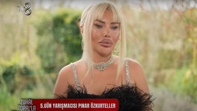 Yemekteyiz Pınar Özkurteller kimdir? Pınar Özkurteller estetiksiz hali nasıldı? İşte yanıtı