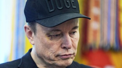 Elon Musk'ın gözünü kim morarttı? Kameraların önünde açıkladı...