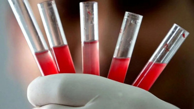 Dünyada bir ilk: Fransız bilim insanları 48. kan grubunu keşfetti