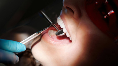 İnci gibi dişlerin sırrı açıklandı! Tek fırçalamada etkisini gösteren doğal karışım!