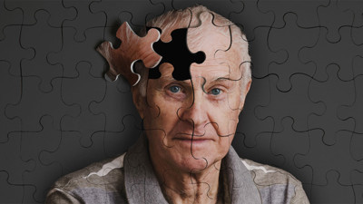 Alzheimer hastalığına çözüm bulundu mu? İşte çığır açacak o mucizevi buluş