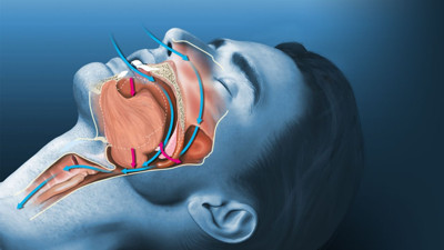 Kalp krizi ve inme riski yüksek! Uykuda belirti veriyor