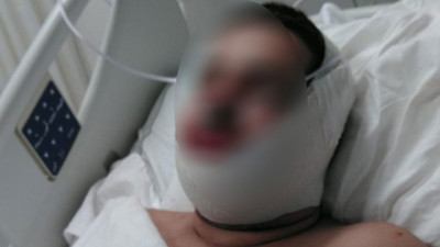 Bakımevinde çenesini dağıttılar!