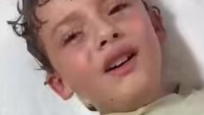 'Kafamın içinde bir şey var' diyen çocuk hastaneye götürüldü! Bakın kafasından ne çıktı