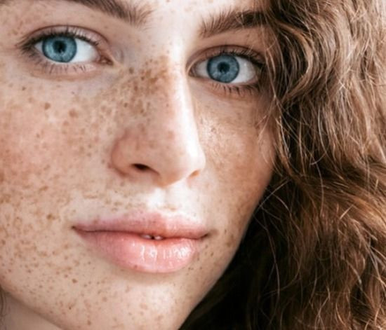 Uzman isim uyardı: Bu hata cilt lekelerine neden oluyor! - Resim: 10