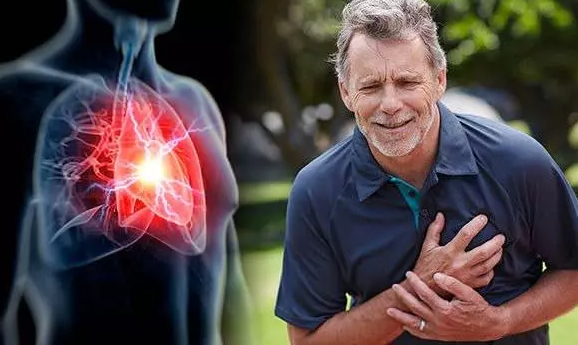 İşte kalp krizi kaynaklı ölümlerin en çok yaşandığı ülkeler! Bakın listedeki birinci ülke hangisiymiş! - Resim: 6