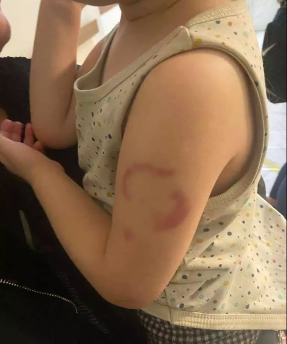 Kreşte kan donduran olay! - Resim : 1