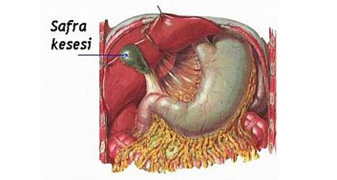 Yağlı yemekten sonra şişkinlik çekenler dikkat! Safra akışı hatası sandığınızdan büyük sonuçlar doğurabilir - Resim: 5