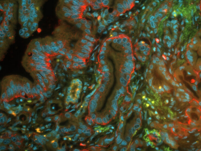 Farelerde hücre yüzey şekerinin artırılması pankreas kanserini yavaşlattı - Resim : 1