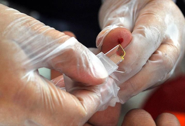 Bu kan gruplarındakiler dikkat! Felç riskiniz yüksek olabilir - Resim: 5