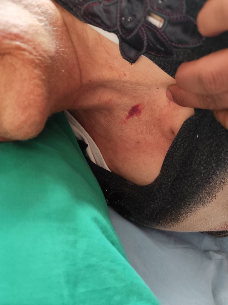 Gaziantep'te özel hastane skandalı! Yoğun bakım ünitesinde şiddet iddiası - Resim : 1