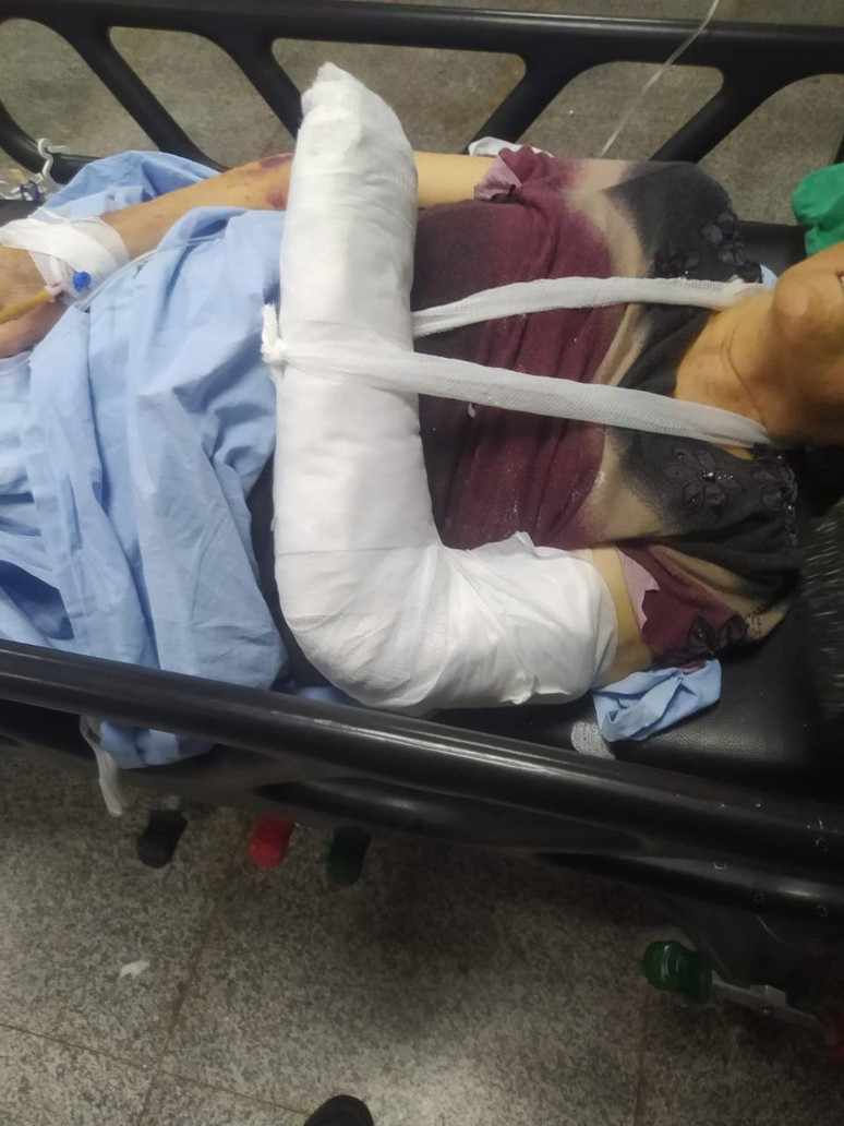 Gaziantep'te özel hastane skandalı! Yoğun bakım ünitesinde şiddet iddiası - Resim : 2