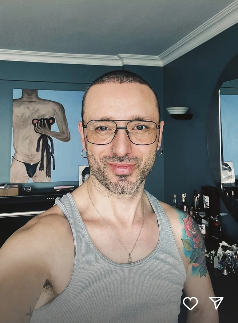 Estetik yaptırmıştı! Mabel Matiz’in yeni imajı olay oldu - Resim : 1