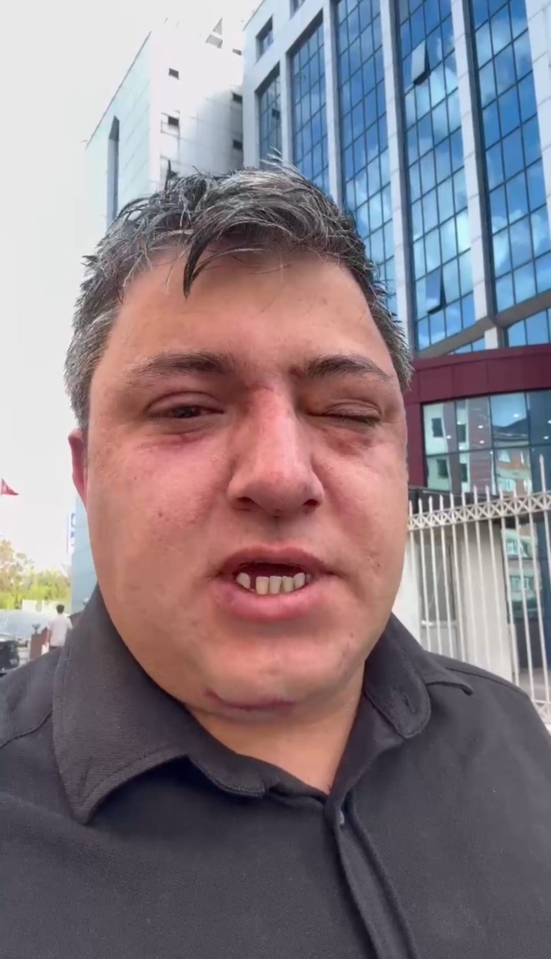 Altındağ Belediyesinde skandallar bitmiyor! Makam odasında 45 dakika dayak - Resim : 2