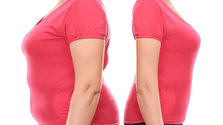 Tüp mide ameliyatı olanlar dikkat! Uzmanı uyardı: Sakın bunları tüketmeyin!