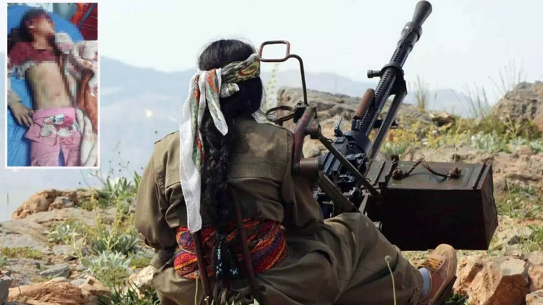 PKK'yı savunanlar bu çocuğa baksın! Havan saldırısında bu hale geldi!