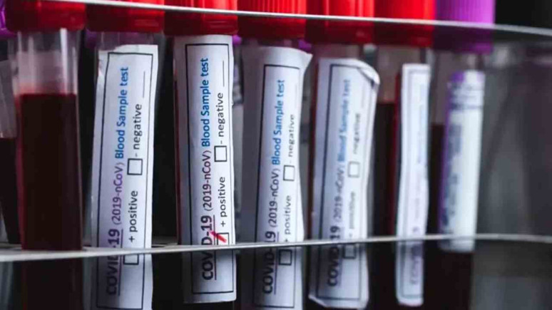 Acı eşiği en yüksek kan grubu ortaya çıktı