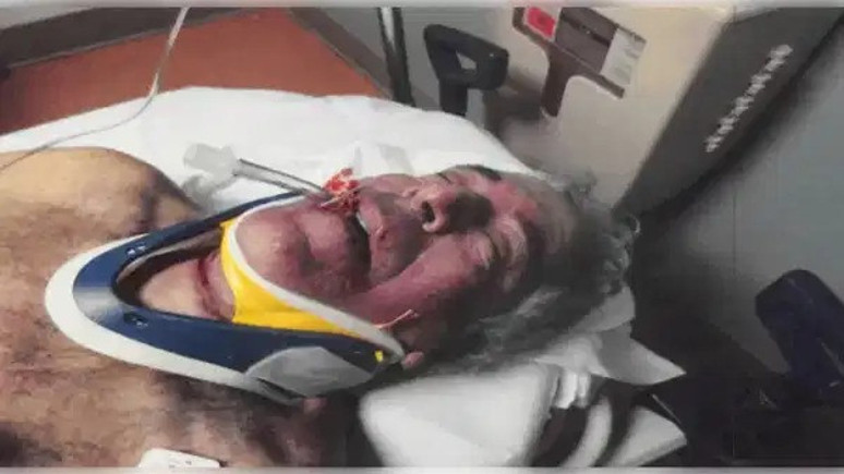 Epstein'in son saatleri: Ölüm anına ait fotoğraflar ortaya çıktı - Resim : 2