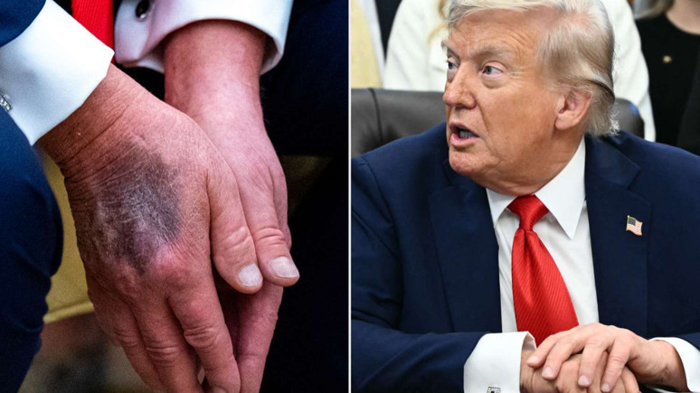 Donald Trump hasta mı? O görüntüsü dikkat çekti - Resim : 2