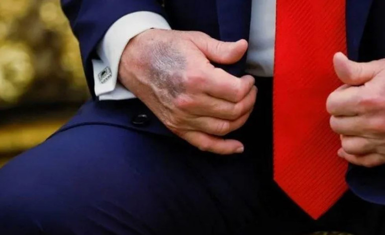 Aranan Trump 6 gün sonra bulundu: Kayıp saatlerinde neredeydi? - Resim : 2