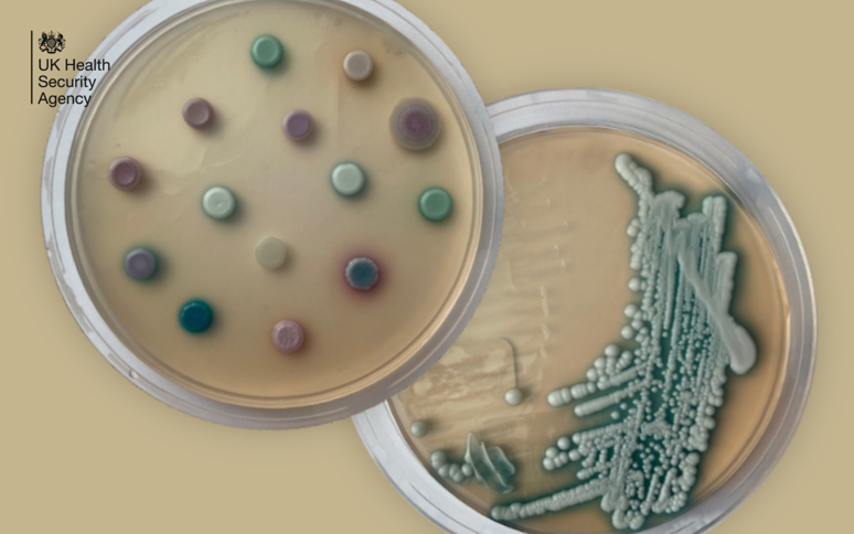 Akıllara The Last Of Us’ı getirdi… İngiltere alamda! Bu ölümcül mantar dezenfektanlara dirençli! - Resim : 1