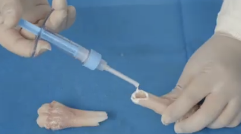 Çinli bilim insanları, kırıkları 3 dakikada iyileştiren 'kemik yapıştırıcısı' geliştirdi! - Resim: 3