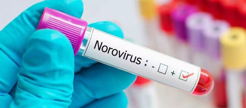 İshal, bulantı ve kusma: Norovirüs vakaları artıyor - Resim: 1