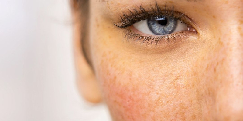 Uzman isim uyardı: Bu hata cilt lekelerine neden oluyor! - Resim: 8