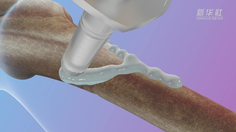 Çinli bilim insanları, kırıkları 3 dakikada iyileştiren 'kemik yapıştırıcısı' geliştirdi! - Resim: 6