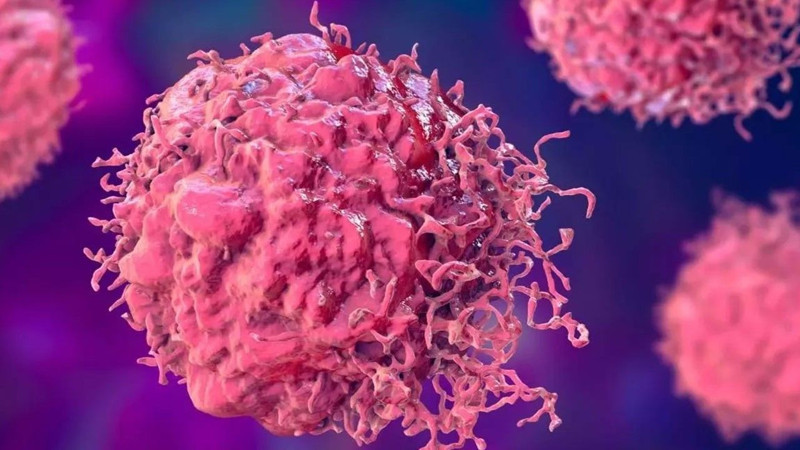 Bu kan grubuna sahip olanlar dikkat! Kansere yakalanabilirsiniz... - Resim: 4