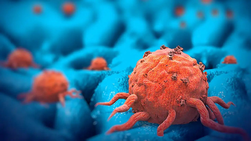 Bu kan grubuna sahip olanlar dikkat! Kansere yakalanabilirsiniz... - Resim: 3