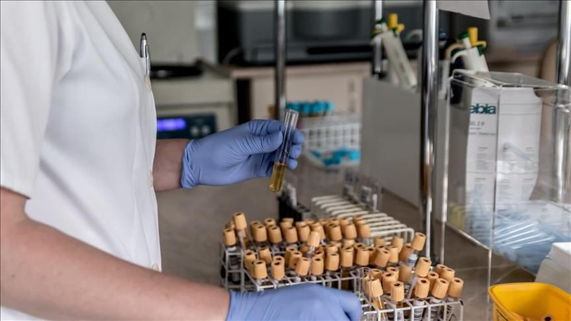 Bu kan gruplarındakiler dikkat! Felç riskiniz yüksek olabilir - Resim: 10